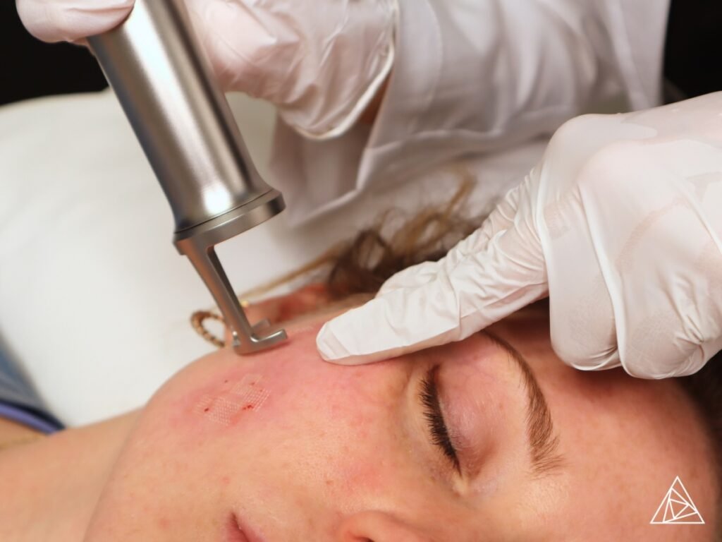 Erbium Yag Laser