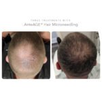 Photo provided by AnteAge MD