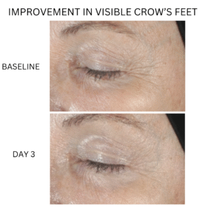 diamond glow before and after