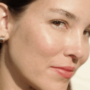 summer allergan model