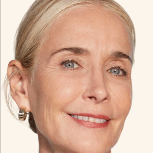 juvederm model